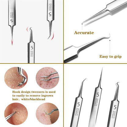 ClearSkin | Blackhead and Acne Removal Tweezers